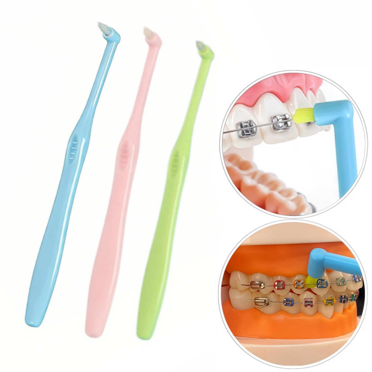 Teeth Whitening With Braces - Cepillo de dientes para ortodoncia, cabezal