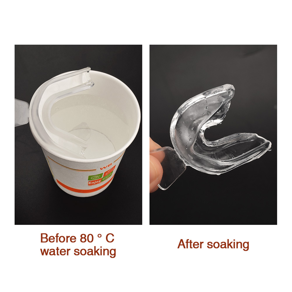 Protector Bucal de Silicona de - Teeth Whitening Mouth Guard reseña y precio