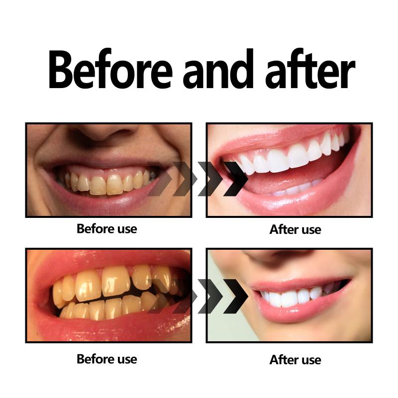 Polvo para blanquear los dient - Teeth Whitening Charcoal Powder reseña y precio