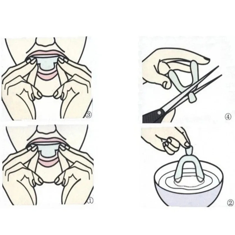1/3/6 pares de protectores buc - Teeth Whitening Mouth Guard reseña y precio