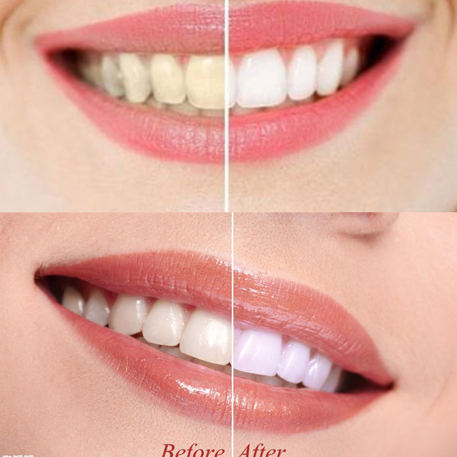 Dientes de carbón de bambú par - Teeth Whitening Charcoal Powder reseña y precio