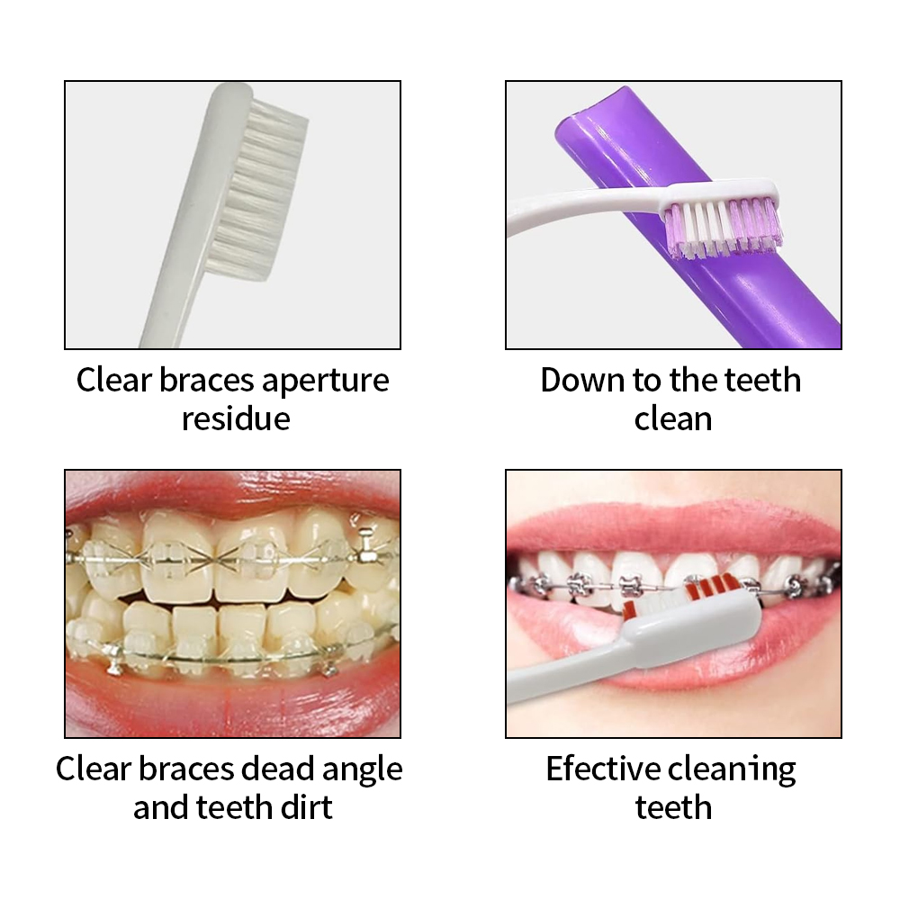 8 unids/set Kit de cepillo de  - Teeth Whitening With Braces reseña y precio