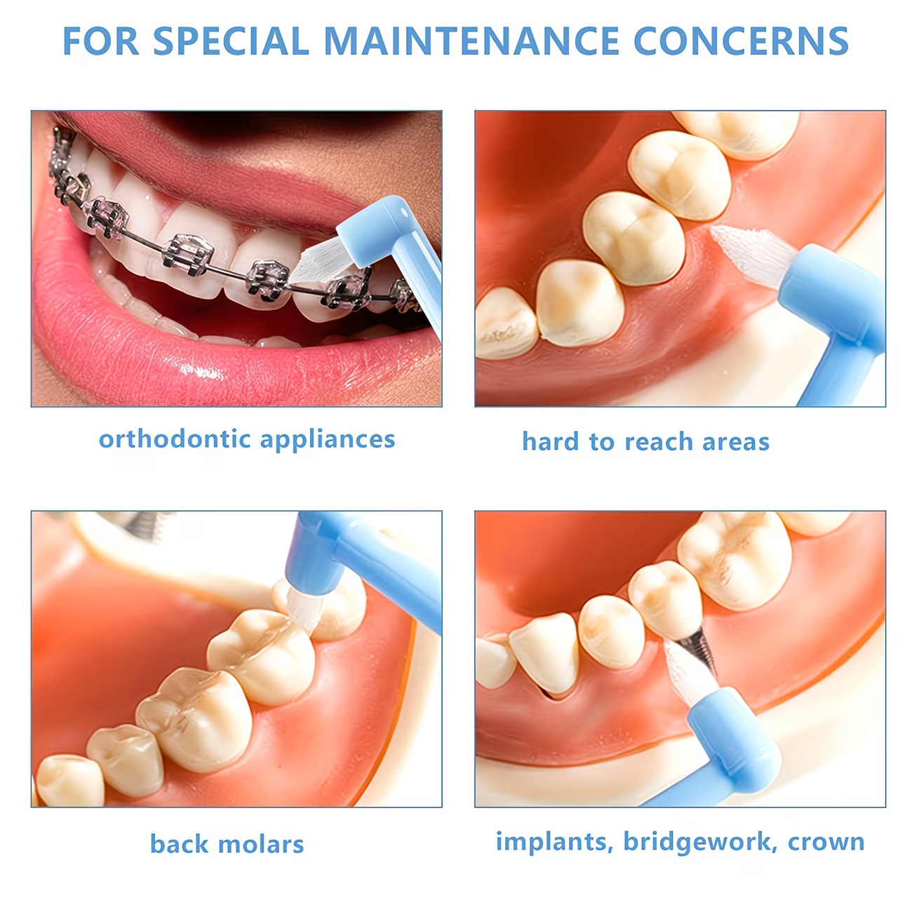 Cepillo de dientes para ortodo - Teeth Whitening With Braces reseña y precio