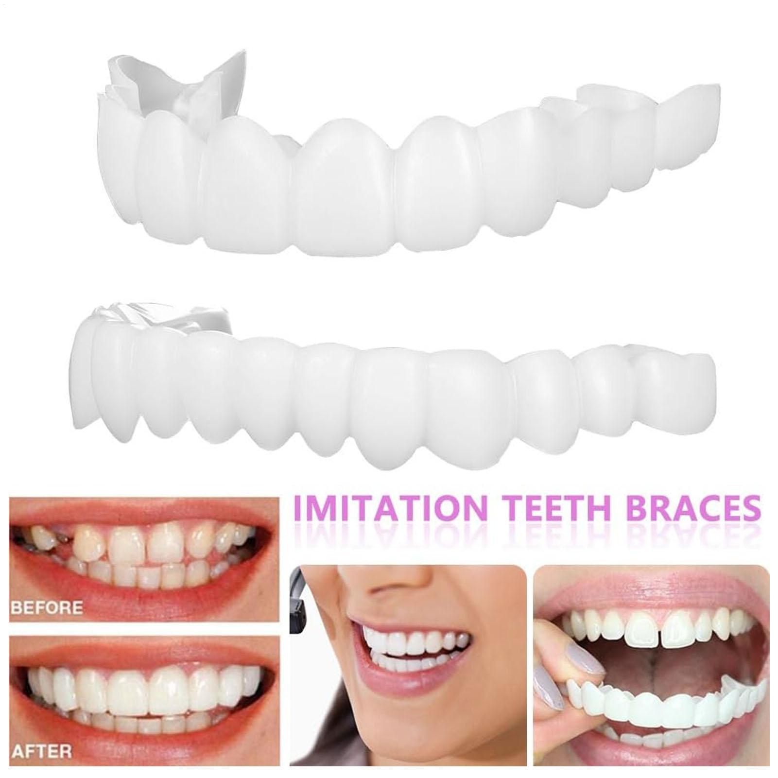 Cubiertas Dentales Superiores  - Teeth Whitening With Braces reseña y precio
