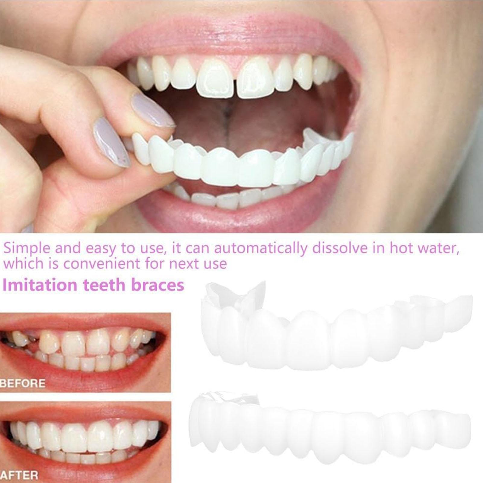 Cubiertas Dentales Superiores  - Teeth Whitening With Braces reseña y precio