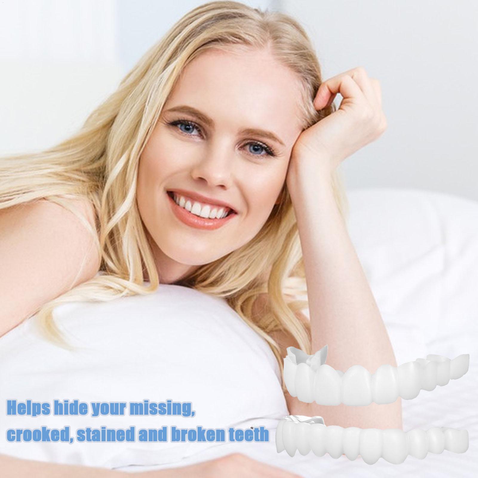 Cubiertas Dentales Superiores  - Teeth Whitening With Braces reseña y precio