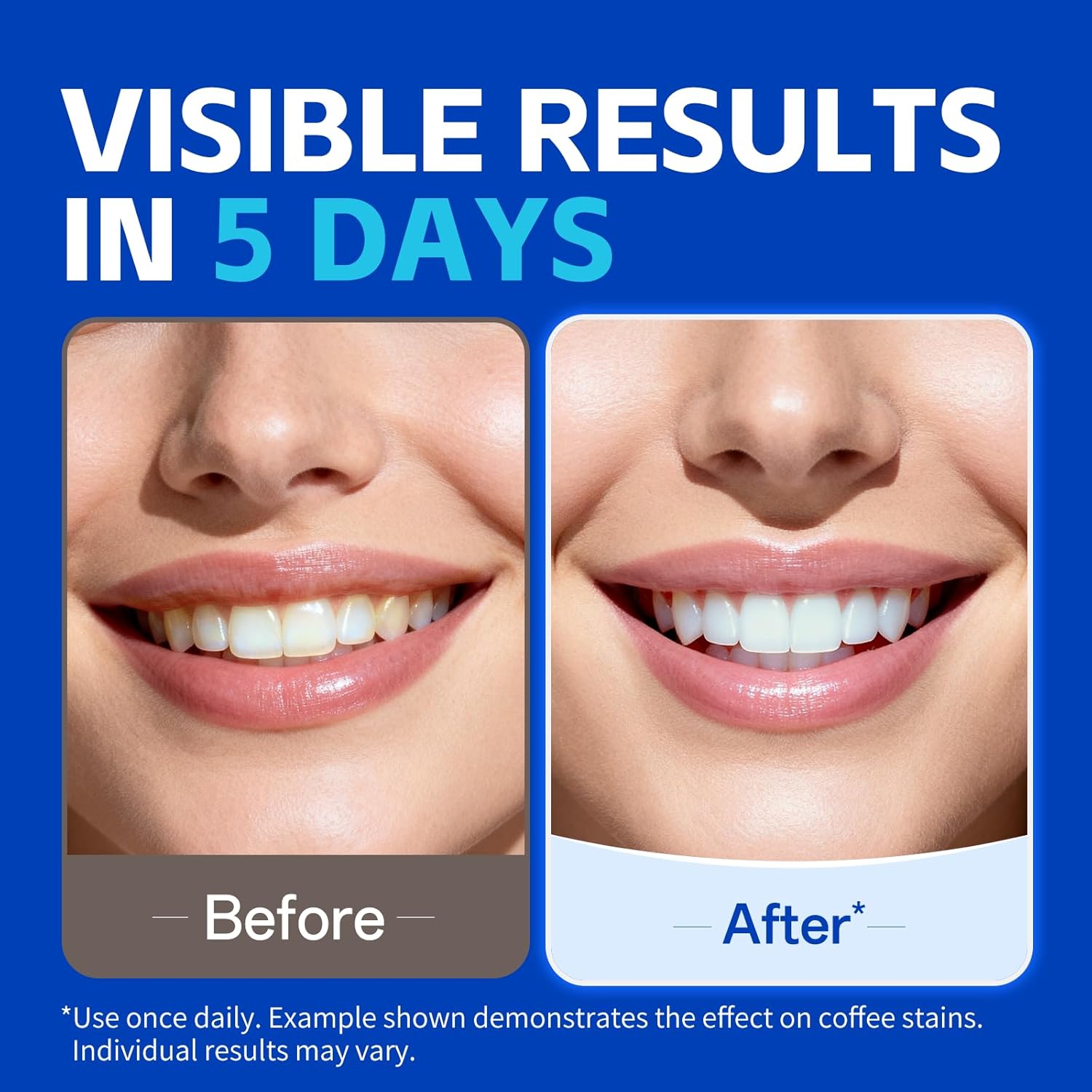 1/7 Pares de Tiras Blanqueador - Teeth Whitening Strips Crest reseña y precio