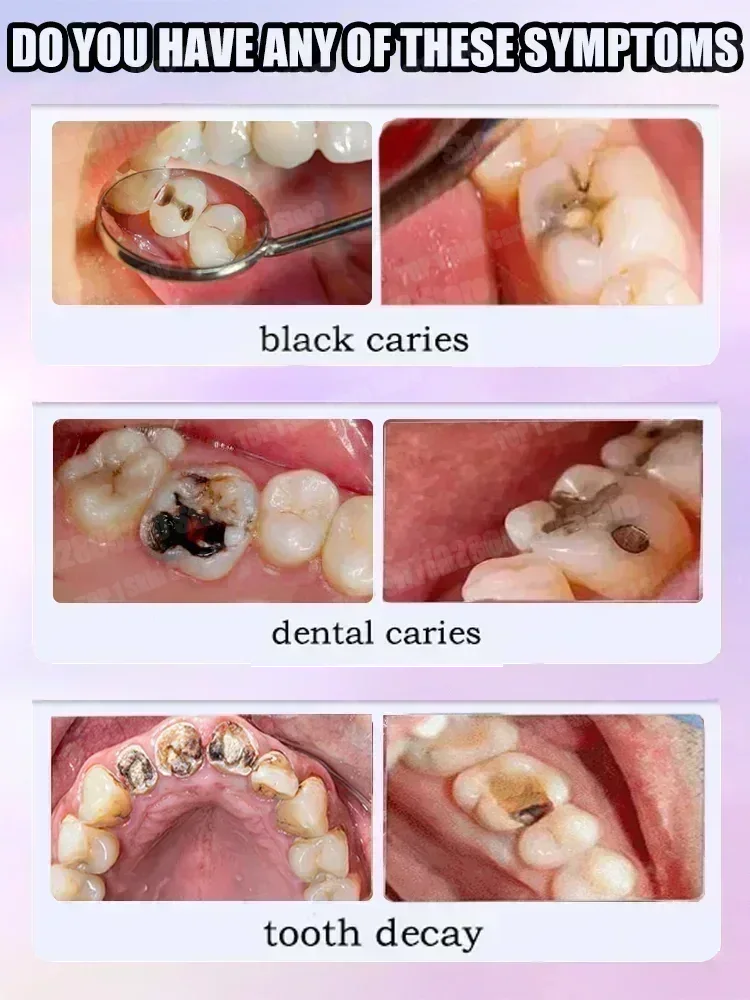 Ventas calientes Más vendido,  - Teeth Whitening Charcoal Powder reseña y precio
