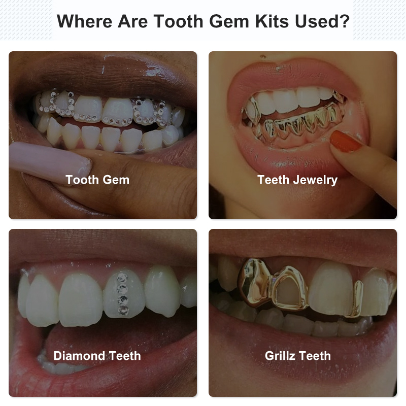 Juego de gemas dentales, Kit d - Uv Whitening Kit reseña y precio